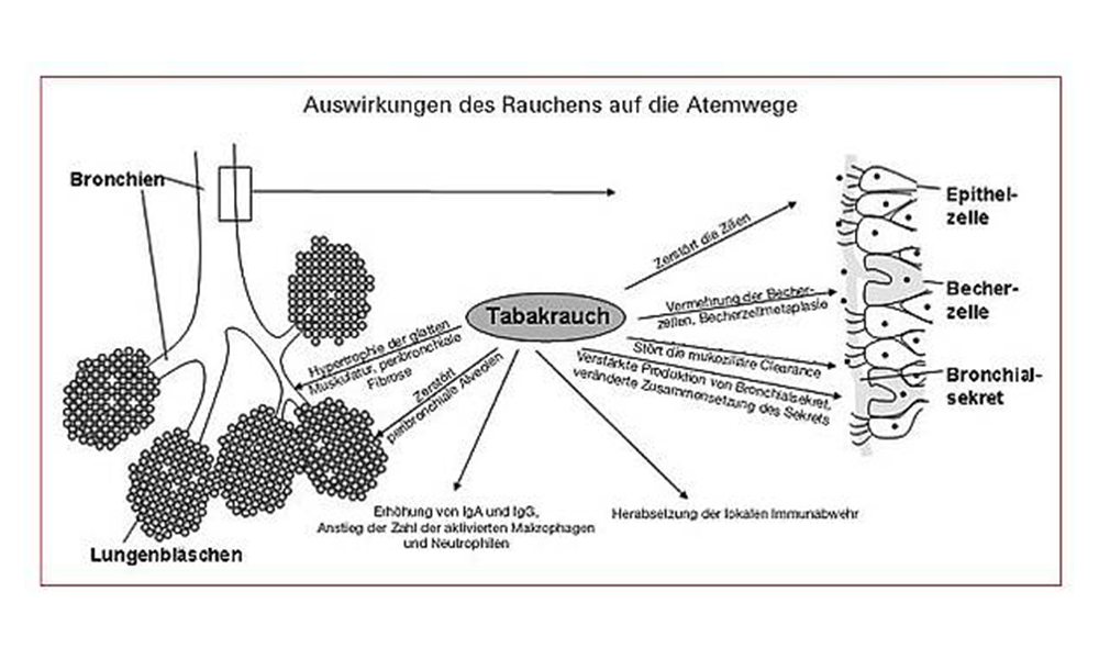 Auswirkungen auf die Atemwege