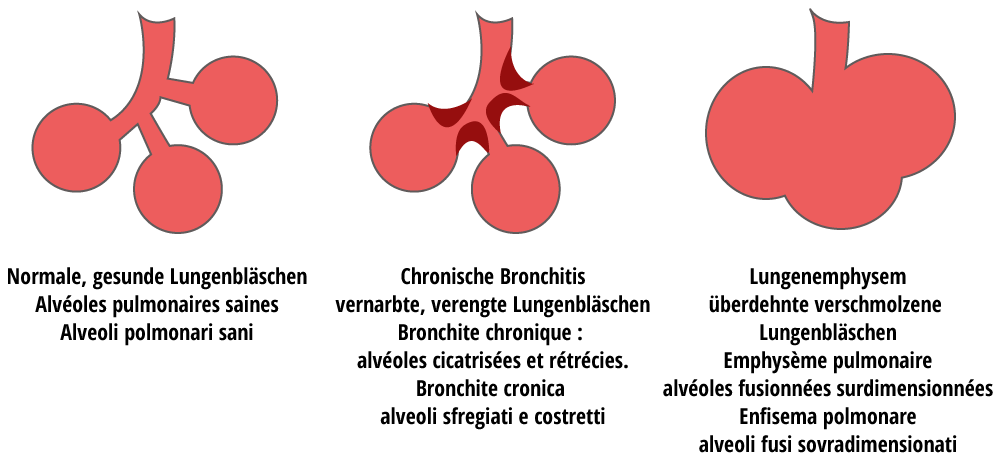 Alvéoles pulmonaires